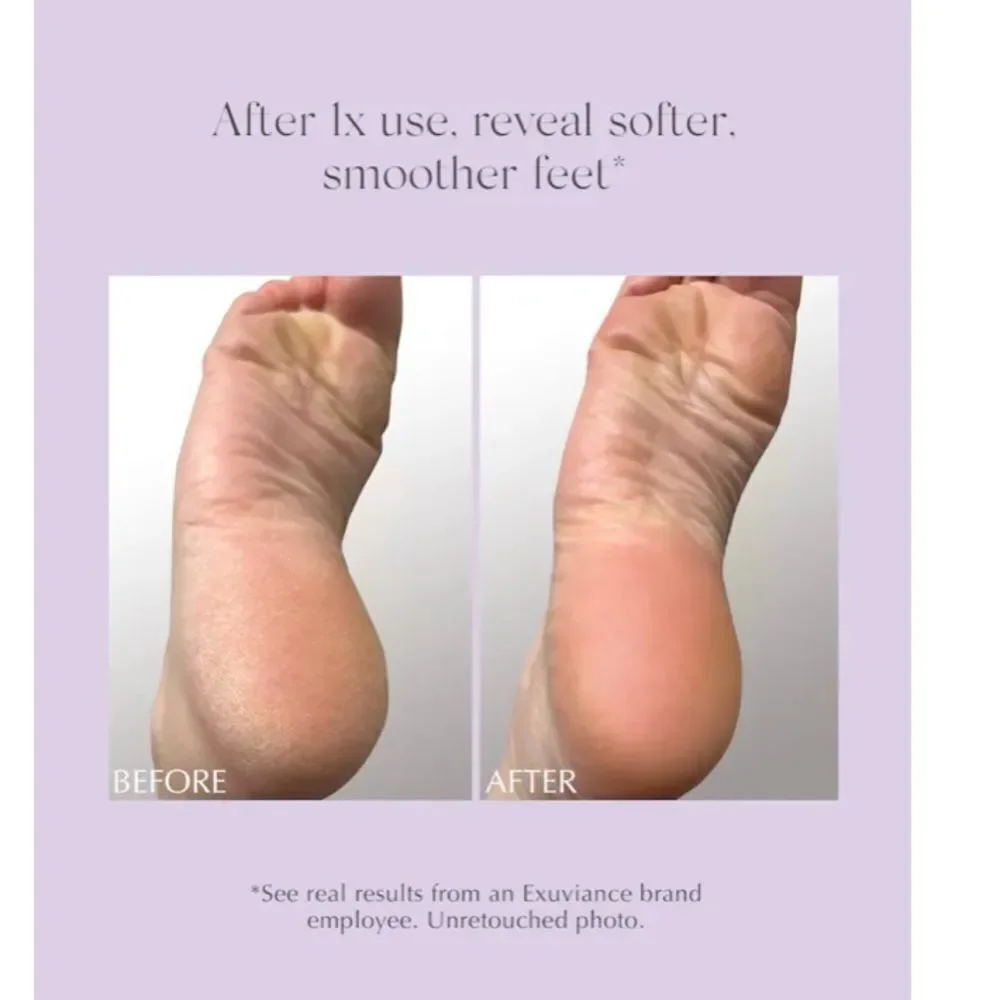 Exuviance Pro Resurfacing Exfoliating & Conditioning Foot Balm